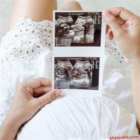 schwangerschafts-bilder-ideen_16